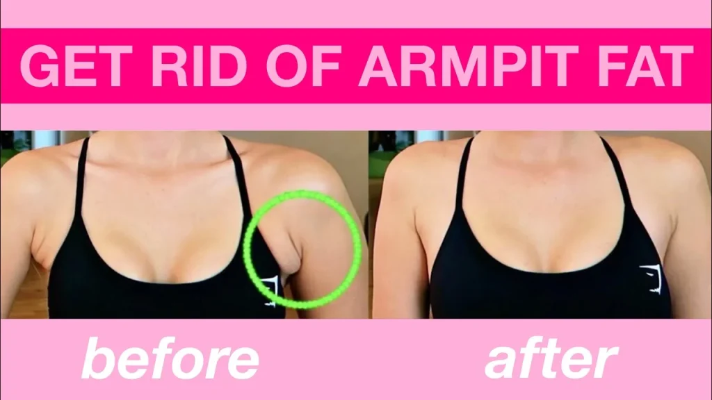 get rid of armpit fat